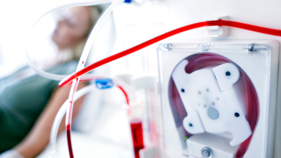 Haemodialysis